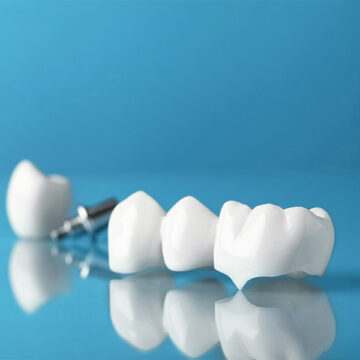Why Are Dental Crowns Needed for Kids’ Teeth?