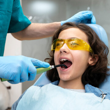 Why Are White Fillings Better for Kids’ Teeth?